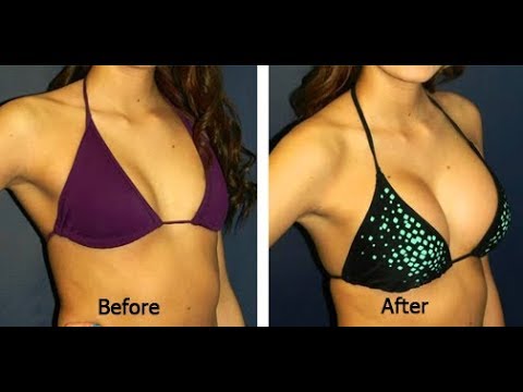 How to get bigger boobs without surgery