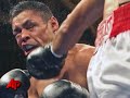 Boxer Wakes Up After Being in Coma for 2 Months