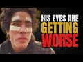 Cosmetic Surgery Fails: The Conspiracy behind Frank Tufano's Botched Eye Surgery