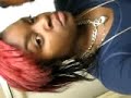 Crazy Children with voice disorders Voice Disorders