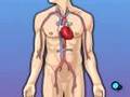 PreOp® Coronary Artery Bypass CABG) Patient Education