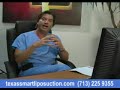 Fat after liposuction Fat after liposuction