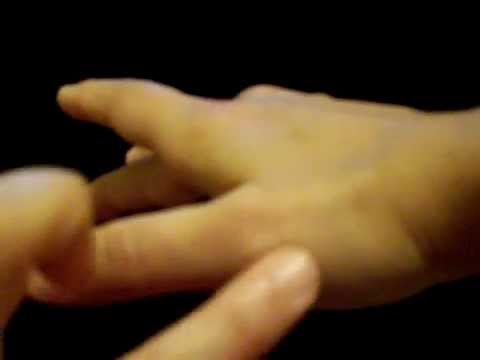 how to relieve thumb pain