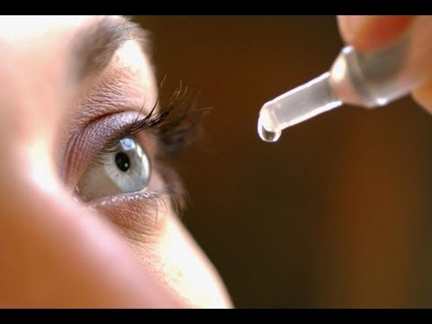 how to administer glaucoma eye drops