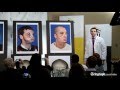 US gun injury victim receives 'most extensive full face transplant ever'