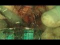 implant dental video preview 15