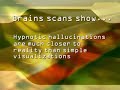 Brain Scans and Hypnosis Brain Scans and Hypnosis