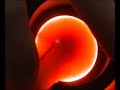 Percutaneous transillumination tecnique (part two)