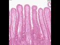 Shotgun Histology Small Intestine Jejunum
