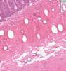 Shotgun Histology Small Intestine Jejunum