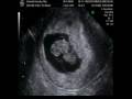 videos de Nuestros Bebes / 8 Semanas