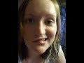 Bells Palsy