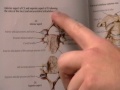 Overview of Vertebrae and Ribs
