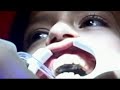 blanqueamiento dental blanqueamiento dental
