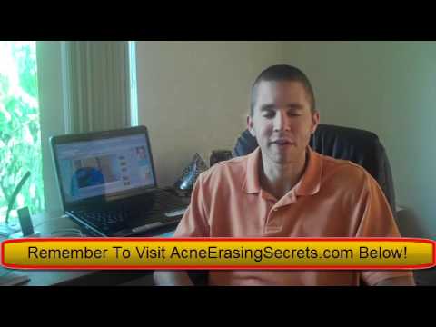 how to steam face for acne