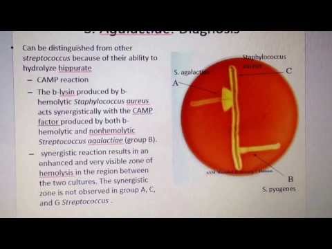 how to isolate streptococcus agalactiae