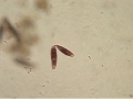 Binary fission Blepharisma