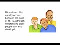 Ulcerative Colitis  Ulcerative Colitis Colitis