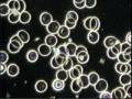 videos de Blood Cell Analysis (French Version) - Colombe Gauvin