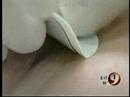 Acne Skin Care Treatment