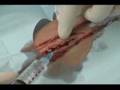 Kelsen's Gashed Leg Gets Stitches