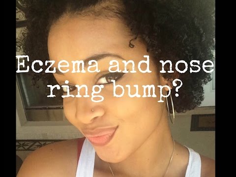 how to get rid nose piercing bump