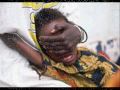 Female Genital Mutilation Video 0001