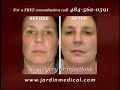 Jardin Medical Thermage Promotion Jardin Medical Thermage Promotion
