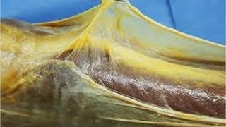 Explications sur les fasciae II (Aleman subtitulado en español)