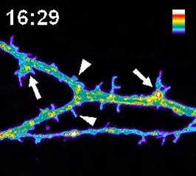 Dendritic Exocytosis of TfR-pHluorin ...