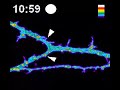 Dendritic Exocytosis of TfR pHluorin Following Glycine Induc