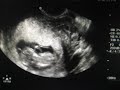 Ultrasound 4: May 1, 2008