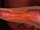 medicalpicture: 3D Animationen und Grafiken medicalpicture: 3D Animationen und Grafiken