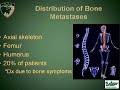 Orthopaedic Surgery Implications of Breast Cancer