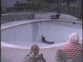 Skateboard-Ouch