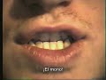 Travis - Laurel Ave (from Singles DVD)
