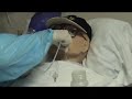 Suction clip 2
