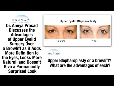 Brow Lift or Blepharoplasty - Why Upper Eyelid Surgery Results in a More Natural and Defined Look