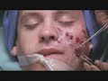 Nip/Tuck 3.11 Abby Mays Trailer Nip/Tuck 3.11 Abby Mays Trailer