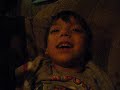 Emory Neill Schizencephaly