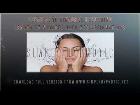 Clear Acne Binaural - Help Cleanse and Clear Up Your Skin With Simply Hypnotic