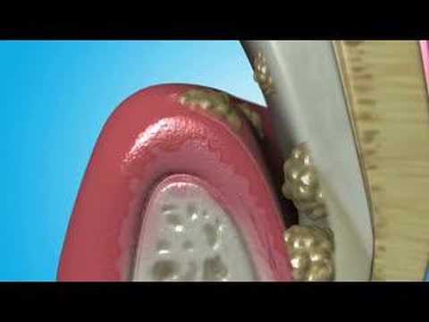 how to cure gum problems