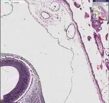 Histopathology Fallopian ...