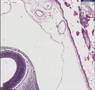 Histopathology Fallopian tube--Ectopic pregnancy with embryo