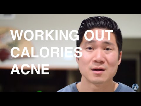 Working Out and Acne - Calories