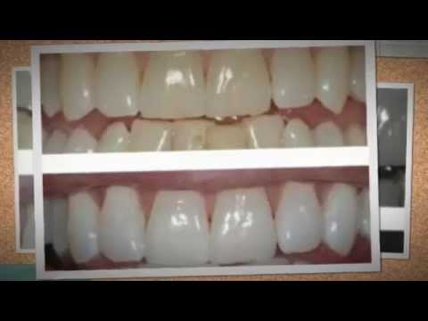 how to whiten hydrogen peroxide