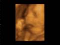 videos de Sami - Yawning