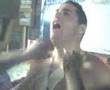 Cat getting his chest hair waxed off