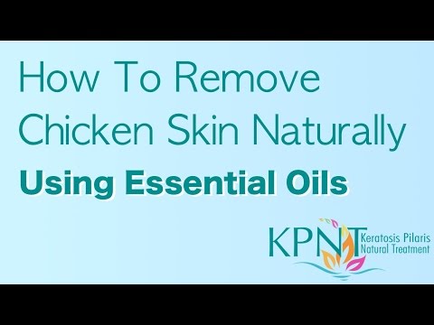 how to use coconut oil for kp