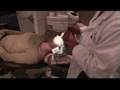 LASIK Experience: Episode 2, part 2